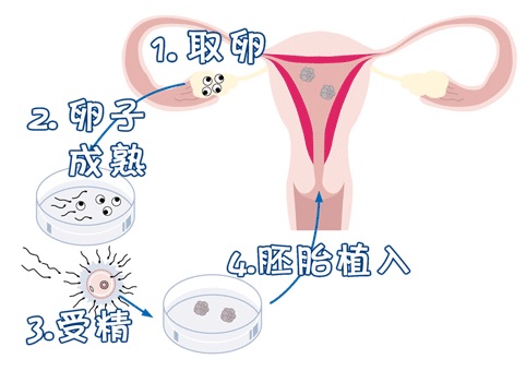 青碧生殖医学中心